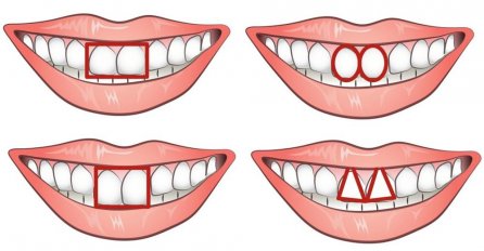 POKAŽI MI ZUBE I REĆI ĆU TI KO SI: Šta oblik vaših zuba otkriva o vašem karakteru?