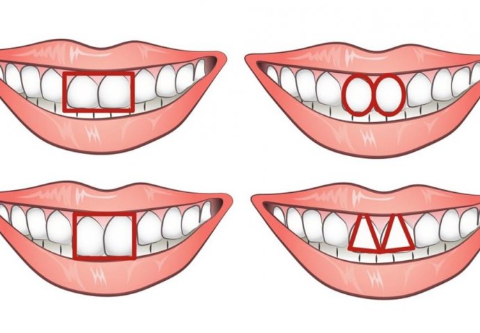 POKAŽI MI ZUBE I REĆI ĆU TI KO SI: Šta oblik vaših zuba otkriva o vašem karakteru?