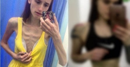 NIKO JE NE PREPOZNAJE: Imala je samo 33 kg, a sada se udebljala I SVI SE OKREĆU ZA NJOM (FOTO)