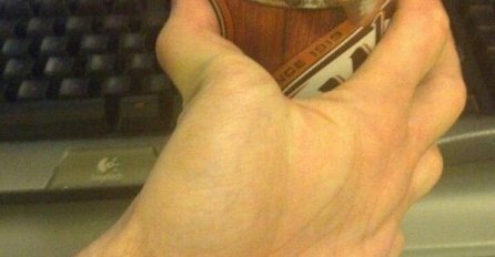 KOLIKO MOŽETE DA IZDRŽITE: Fotografije zbog kojih ćete se osjećati neugodno gledajući ih