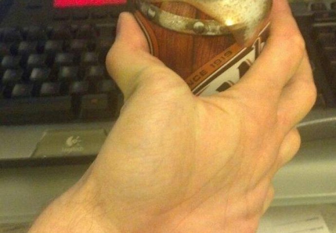 KOLIKO MOŽETE DA IZDRŽITE: Fotografije zbog kojih ćete se osjećati neugodno gledajući ih