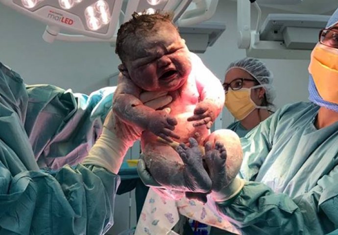 OBORILA REKORD BOLNICE: Beba rođena sa 6,10 kilograma, svojim dolaskom na svijet sve je iznenadila (FOTO)