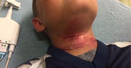 HOROR: Tinejdžeri objesili dječaka na drvo, pa ga verbalno i fizički zlostavljali