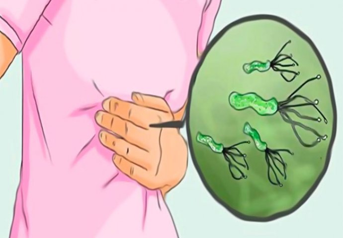 ČUDOTVORNA MJEŠAVINA: Riješite se bakterije Helicobacter pylori u tren oka!!