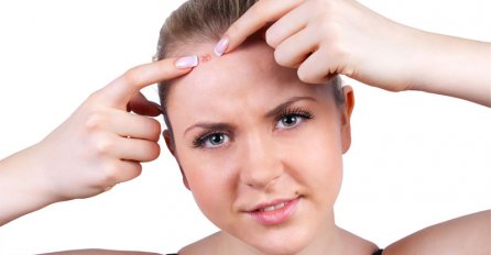 VAŠE LICE BEZ AKNI: Prirodni preparati za besprekorno čišćenje lica