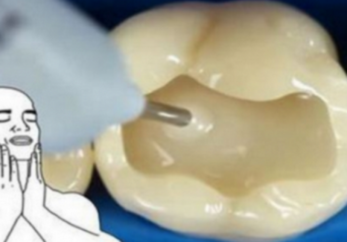 VIDEO KOJI ĆETE ODGLEDATI U JEDNOM DAHU: Ovako vam zubar popravlja zube !