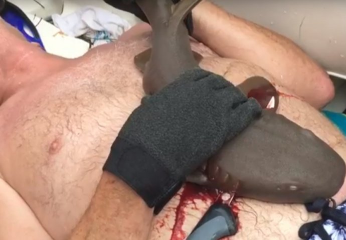 HOROR: Morski pas mu je zabio zube u stomak, a onda je uslijedila borba na život i smrt! (UZNEMIRUJUĆI SNIMAK)