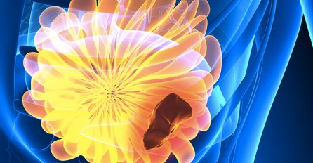 SPASITE SVOJ ŽIVOT: Ove promjene na grudima nikada ne smijete ignorisati! 