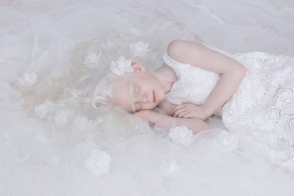 beautiful-albino-people-albinism-9-582ebf00d33b0-880-622x415