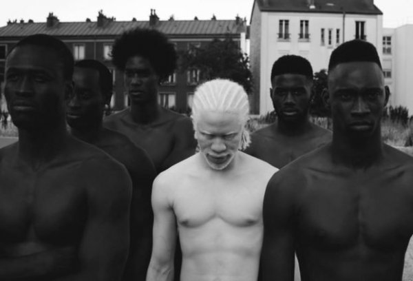 beautiful-albino-people-albinism-9-582f0ef1a3bc2-880-622x423