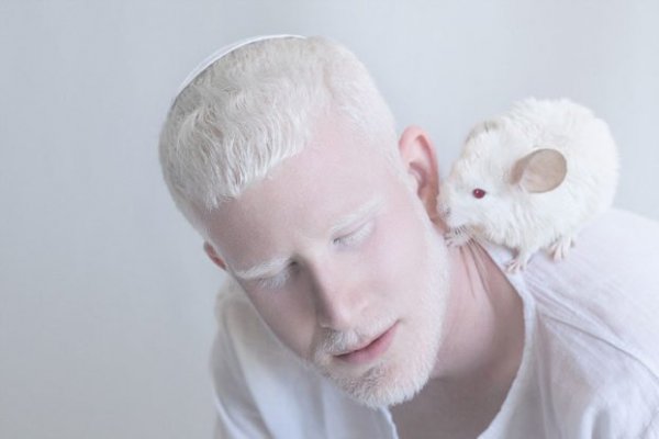 beautiful-albino-people-albinism-12-582ebf0687ed7-880-622x415