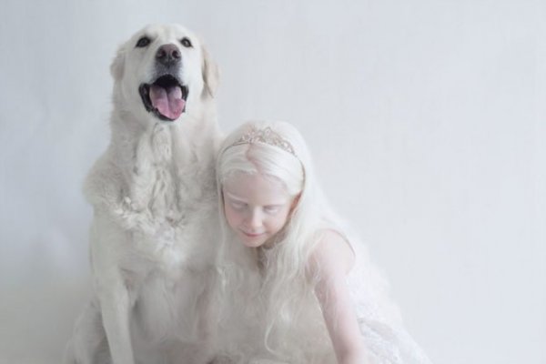 beautiful-albino-people-albinism-16-582ebf0fb73c7-880-622x415