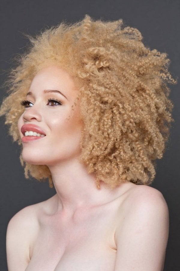 beautiful-albino-people-albinism-28-582ed6222ccf8-880-622x933