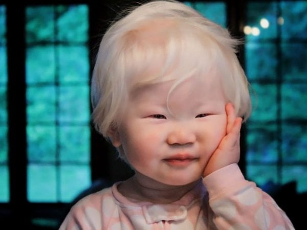 beautiful-albino-people-albinism-37-582efaa64409b-880-622x467