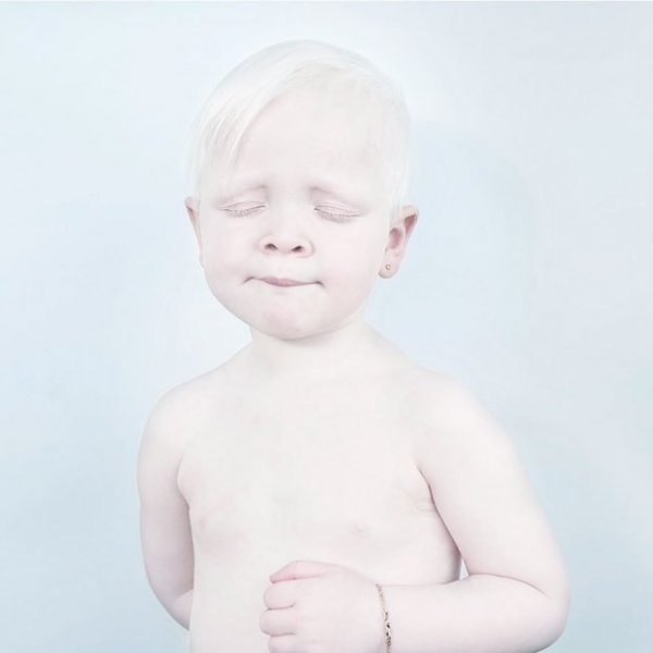 beautiful-albino-people-albinism-44-582f0461c53f7-880-622x622