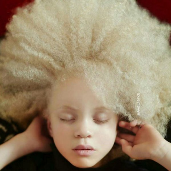 beautiful-albino-people-albinism-46-582f0ea51b8b1-880-622x622