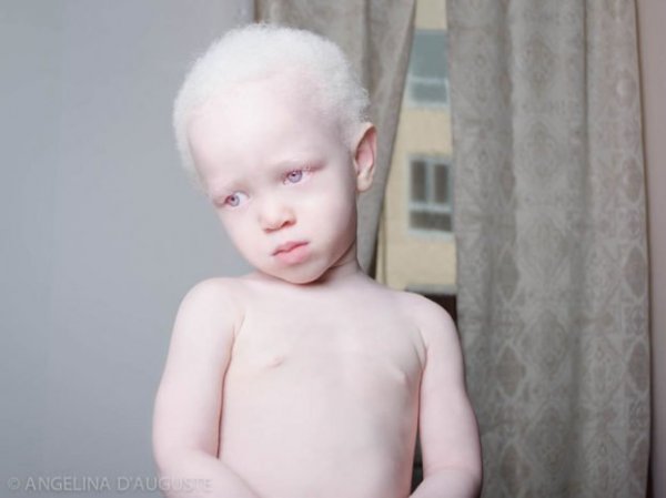 beautiful-albino-people-albinism-52-582f01508ed67-880-622x466