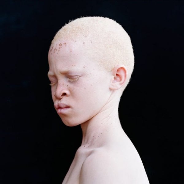 beautiful-albino-people-albinism-53-582f0302ae875-880-622x622