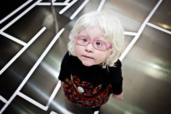 beautiful-albino-people-albinism-56-582f064116962-880-622x415