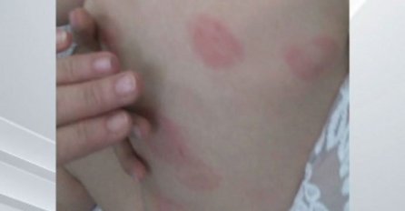 Vaspitačici niža plata kazna za izujedanu bebu u Banjoj Luci