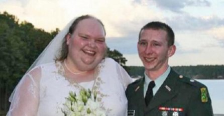 Bila je najružnija mlada na svijetu i svi su joj se smijali! POGLEDAJTE KAKO IZGLEDA DANAS!