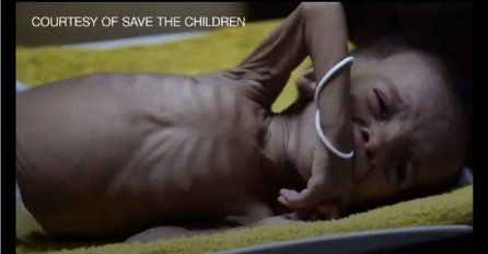 Jemenu prijeti najveća glad na svijetu (UZNEMIRUJUĆE SNIMKE)