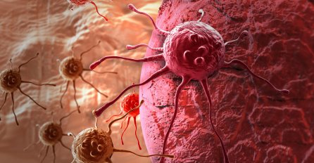 NJEMAČKI NOBELOVAC ŠOKIRAO SVIJET: Rak se dobija od ove DVIJE NAMIRNICE, da su znali ljudi ne bi tako brzo UMIRALI!