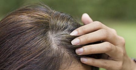 Kako učinkovito kamuflirati sijedu kosu?