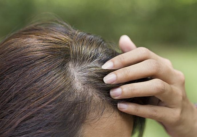 Kako učinkovito kamuflirati sijedu kosu?