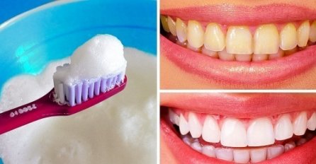 10 najbržih načina da prirodno izbijelite žute zube