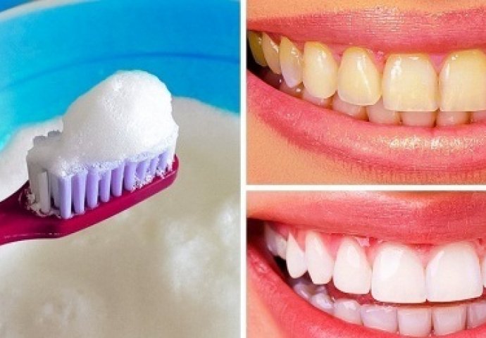 10 najbržih načina da prirodno izbijelite žute zube