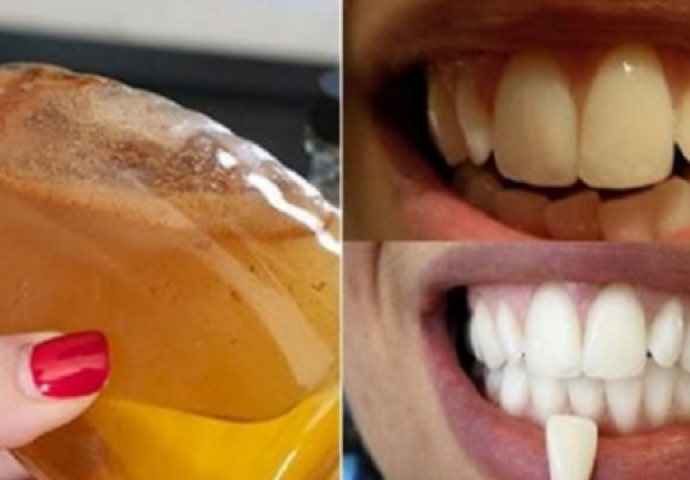 Ispirite usta samo ovim  sastojkom i gledajte šta se dešava sa vašim zubima!