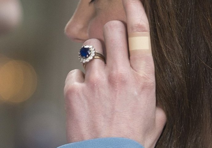 Da li ste primijetili da engleska vojvotkinja Kejt Midlton UVIJEK nosi flastere na prstima: Znate li zbog čega?