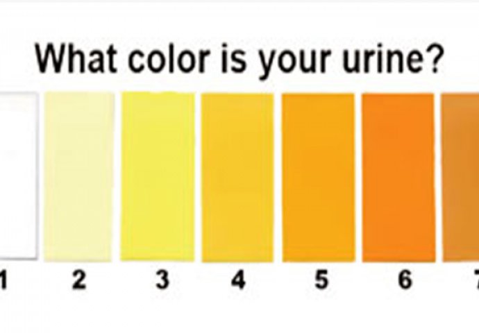 VEOMA OPASNO: Ako je vaš urin OVE boje ujutro, morate HITNO posjetiti ljekara!