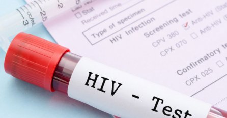 ALARMANTAN BROJ ZARAŽENIH:  Epidemija HIV-a u Evropi