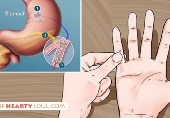 Da saznate prijeti li vam dijabetes potrebna je vaša ruka i jedna minuta: POGLEDAJTE KAKO!