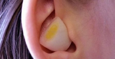 Šta se dogodi kada stavite bijeli luk u uho? ODGOVOR ĆE VAS IZNENADITI!