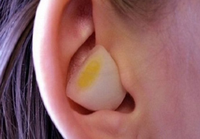 Šta se dogodi kada stavite bijeli luk u uho? ODGOVOR ĆE VAS IZNENADITI!