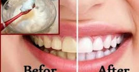 Da i vaši zubi budu kao sa reklame: Uz pomoć ove tri stvari izbijelite zube za samo sat vremena
