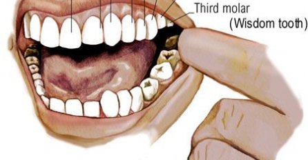 Bol u zubu predviđa probleme pojedinog organa, svaki zub je POVEZAN sa nekim organom u tijelu