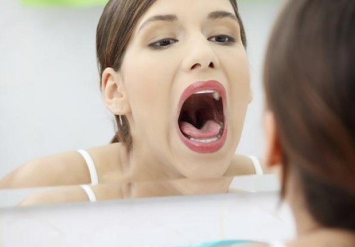 10 simptoma raka usta koje oboljeli rijetko prepoznaju na vrijeme