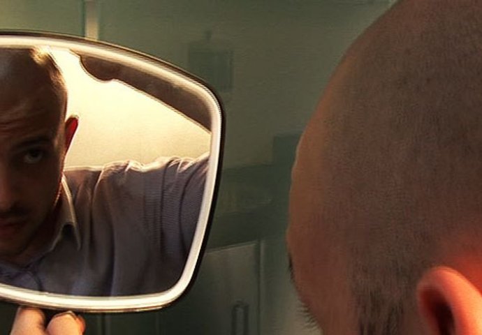 Momak se ošišao na ćelavo, a onda je primijetio da nešto OPASNO nije uredu sa njegovom glavom (FOTO)