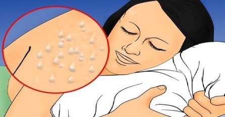 ZNOJITE SE NOĆU? Odmah kod doktora, možda imate neku od ovih ozbiljnih bolesti!