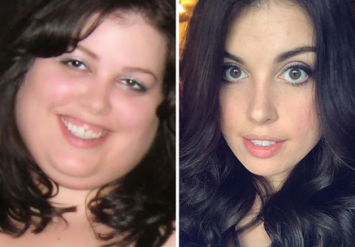 MORATE I NA OVO BITI SPREMNI: Fotografije prije i poslije mršanja otkrivaju kako gubitak kilograma utječe na izgled lica