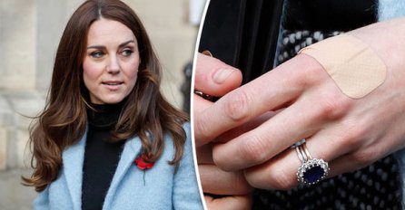 JESTE LI PRIMIJETILI DA KATE MIDDLETON UVIJEK NOSI FLASTERE NA PRSTIMA? Bićete zapanjeni kada čujete pravi razlog za ovo (FOTO)