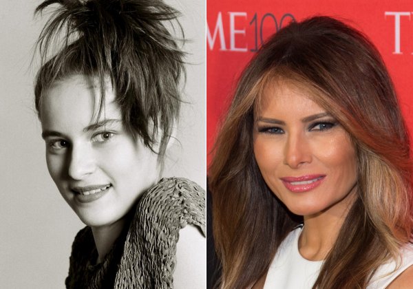 melania-trump-before-and-afterjpg