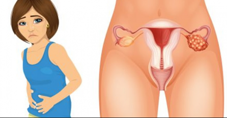 Ovo koriste skoro sve žene, a udvostručuje rizik od raka jajnika