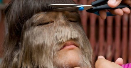 NEĆETE VJEROVATI SVOJIM OČIMA: Najdlakavija žena na svijetu obrijala sve dlake, POGLEDAJTE KAKO SADA IZGLEDA (FOTO)