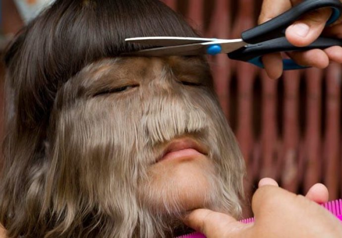 NEĆETE VJEROVATI SVOJIM OČIMA: Najdlakavija žena na svijetu obrijala sve dlake, POGLEDAJTE KAKO SADA IZGLEDA (FOTO)