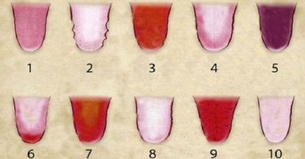 OBRATITE PAŽNJU: BOJA jezika otkriva sve o vašem ZDRAVLJU! Koje je boje vaš?
